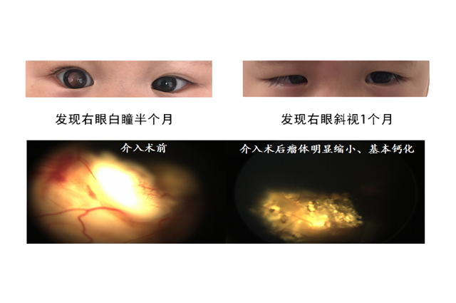 QQ浏览器截图20181128171303副本.png